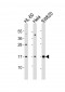 UBE2N Antibody (Center)